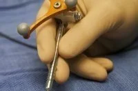 Raman spectroscopy: Shedding light on brain surgery