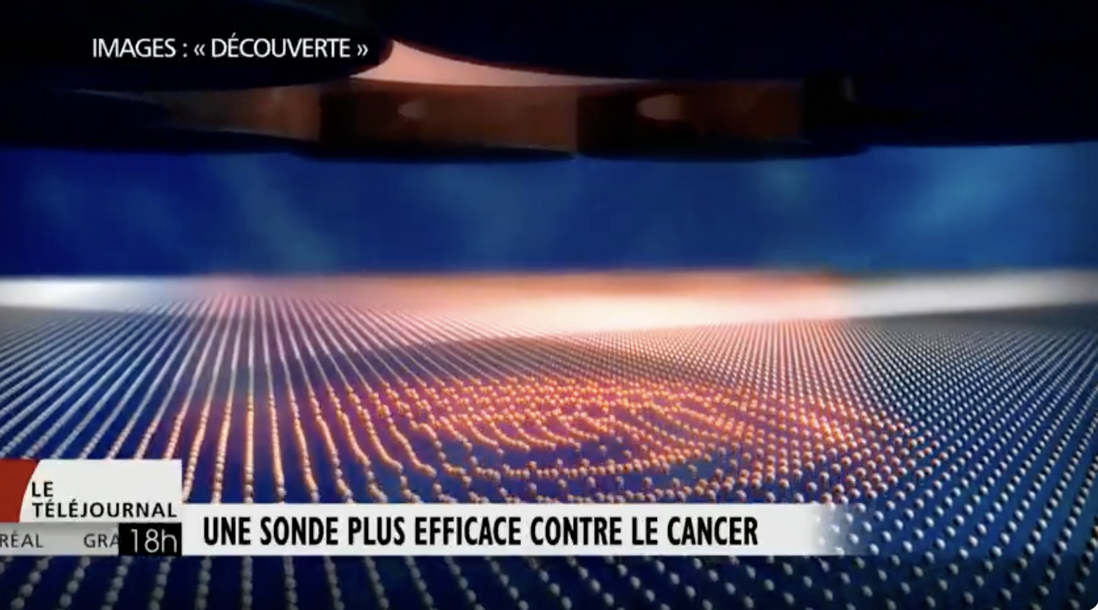 Une sonde détecte toutes les traces de cancer