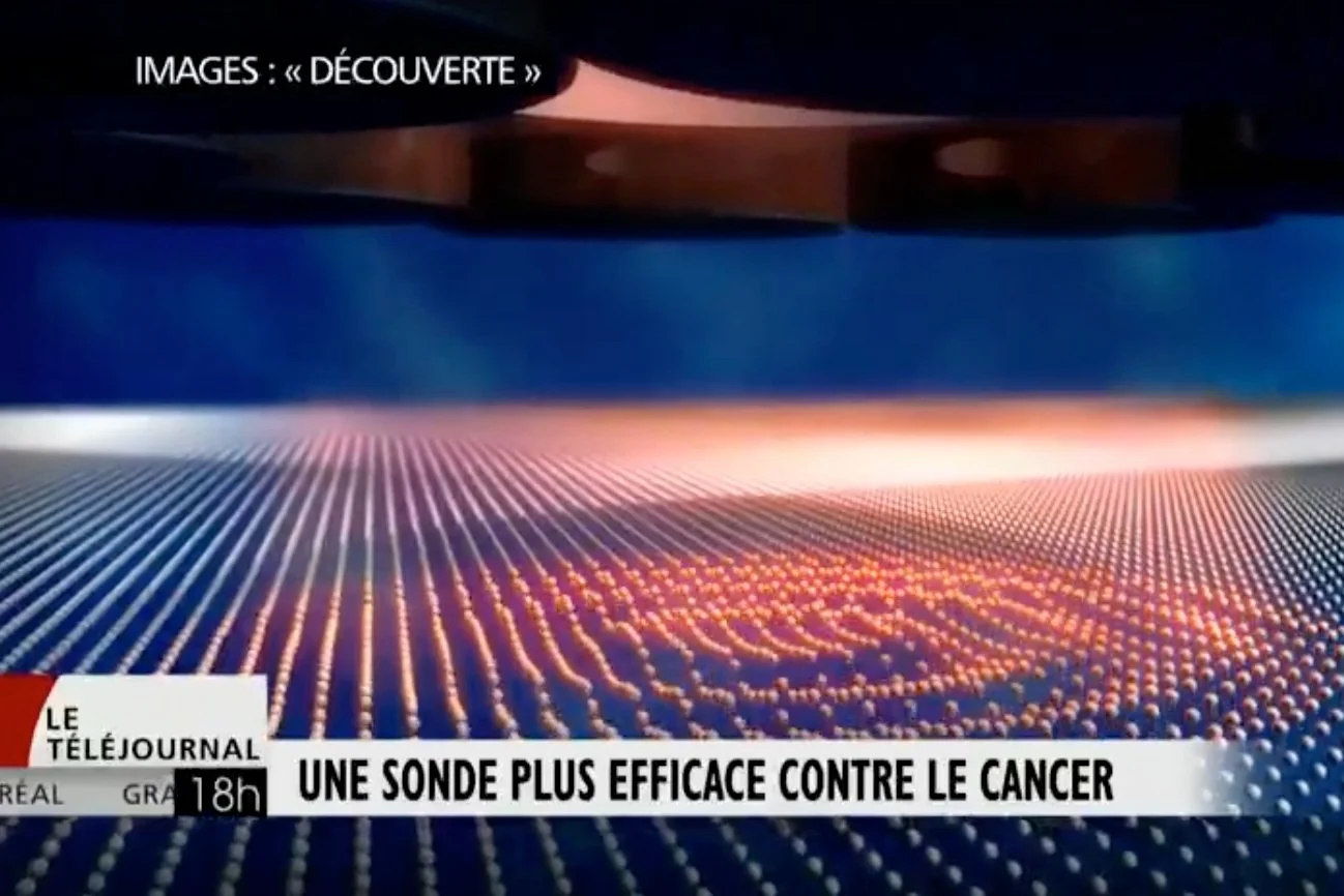 Une sonde détecte toutes les traces de cancer