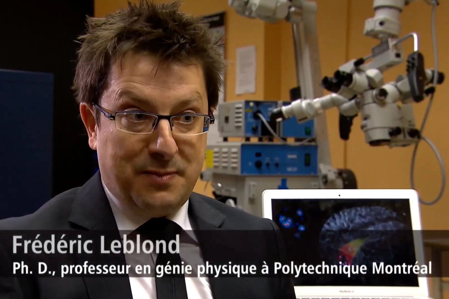 Une sonde pour détecter le cancer du cerveau