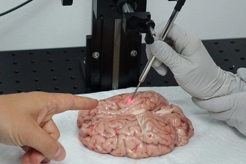 Une sonde pour détecter le cancer