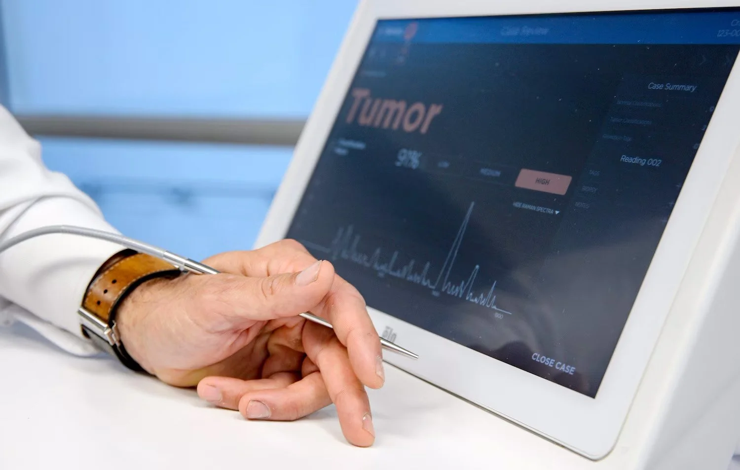 Technology detect cancer