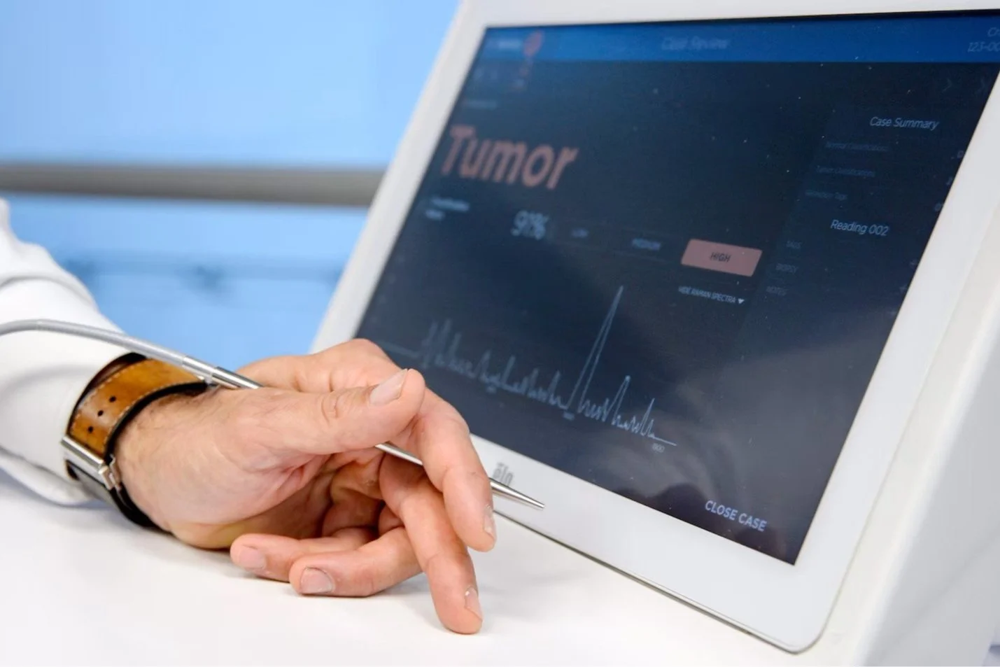 Une technologie conçue au Québec pour détecter les tissus cancéreux pourrait bientôt se retrouver dans les blocs opératoires du monde entier