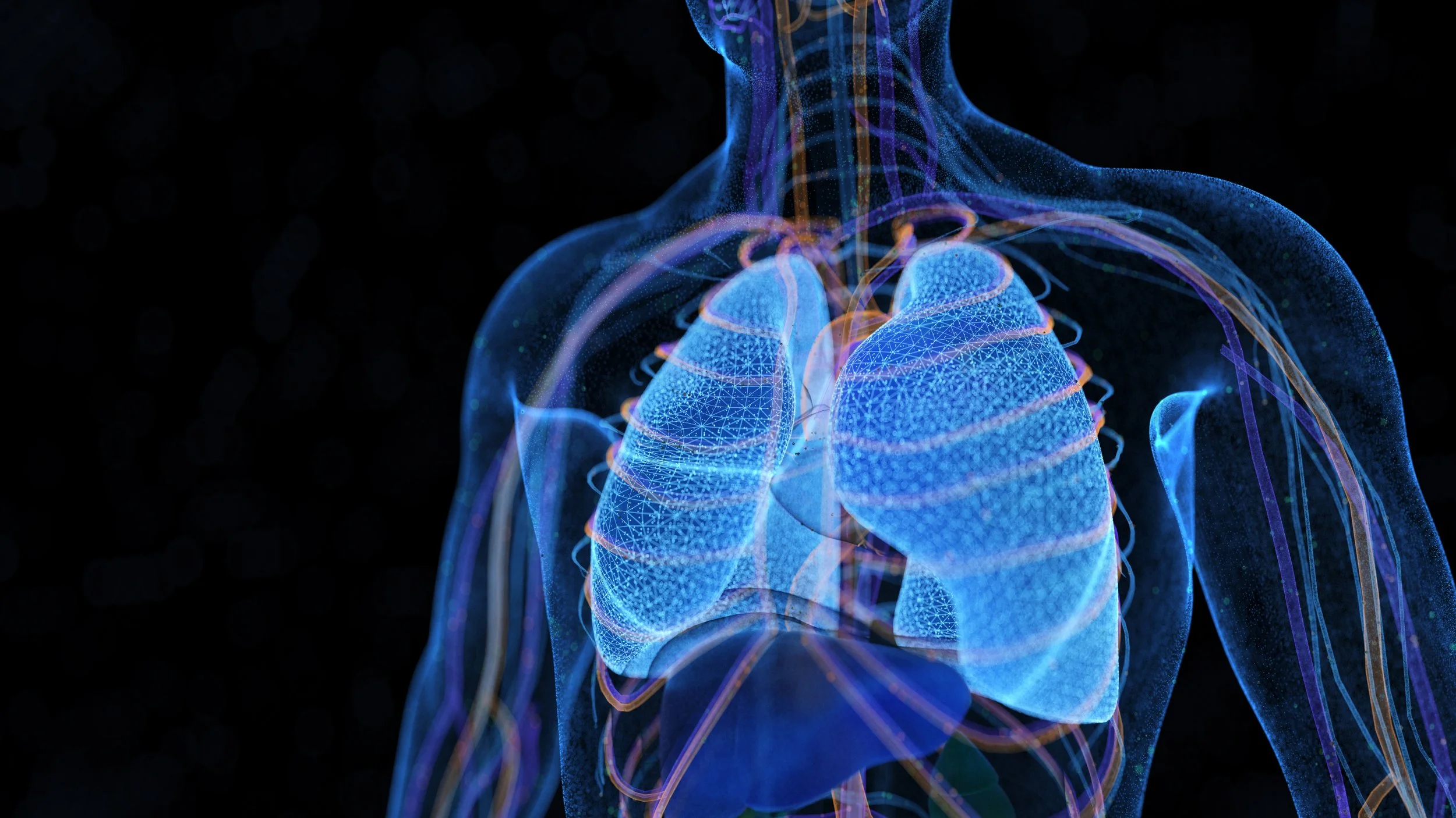 SU2C Challenge Program Aims to Accelerate Lung Cancer Early Detection