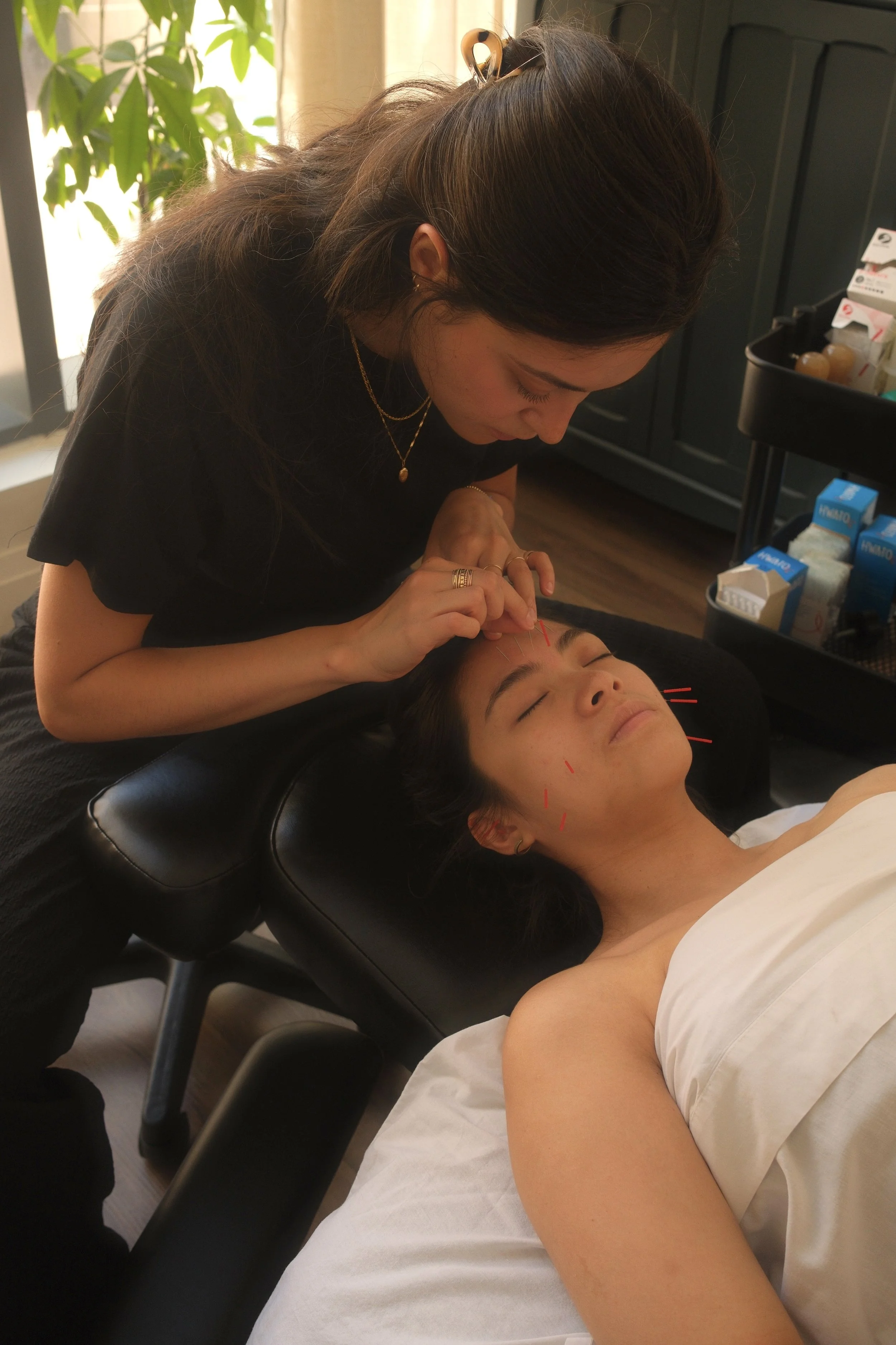 A woman receiving acupuncture treatment on her face while lying on a treatment bed in a wellness clinic.