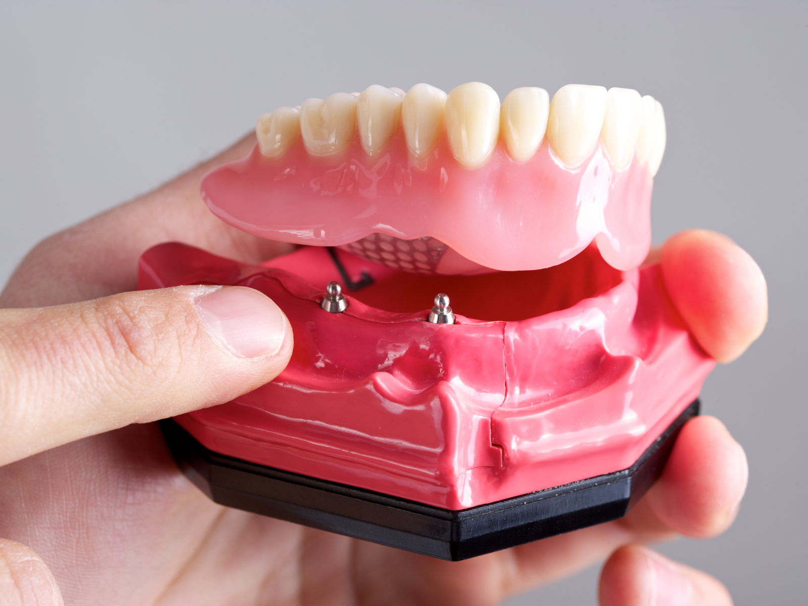 model of denture and dental implant