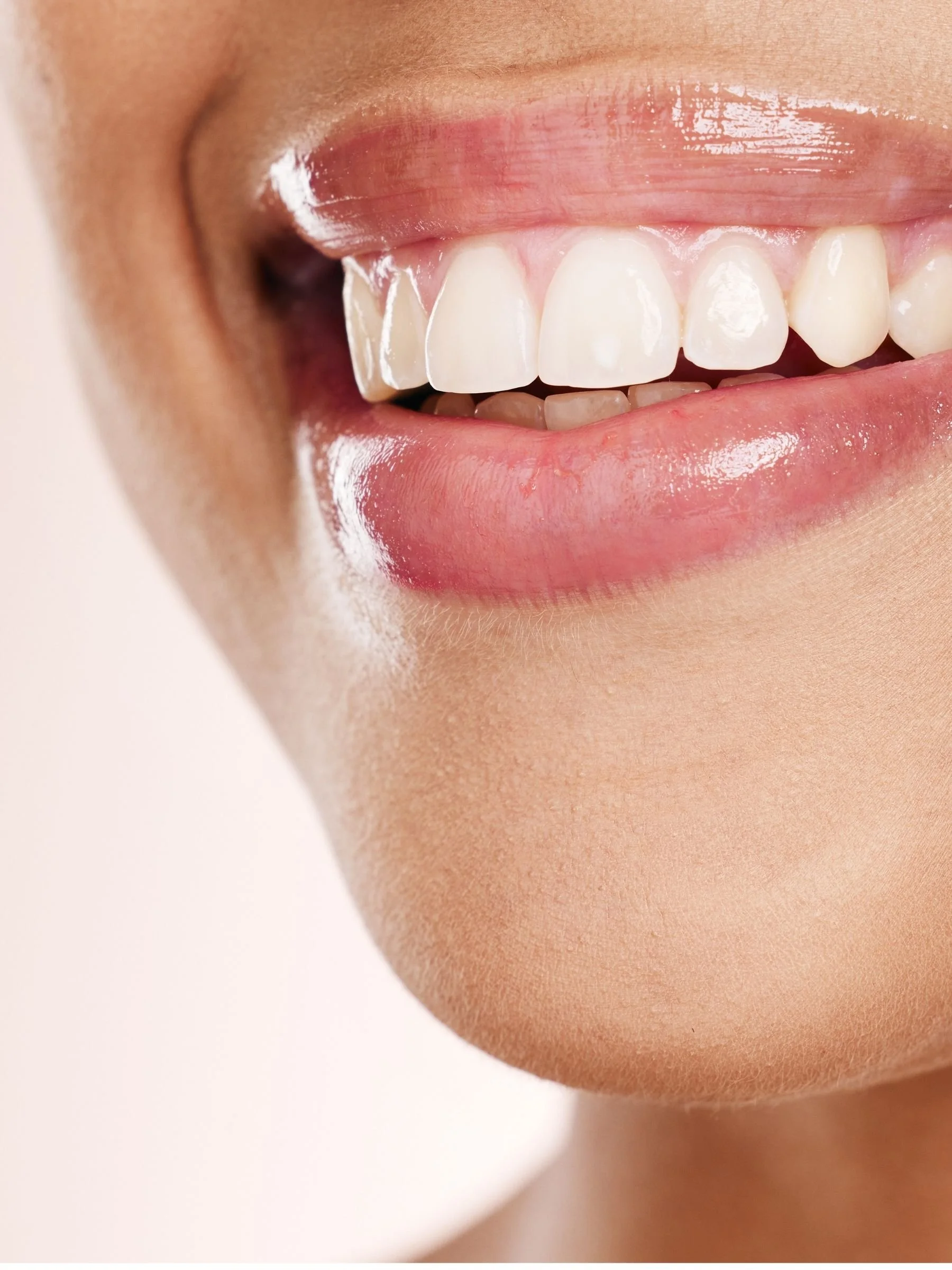 white teeth