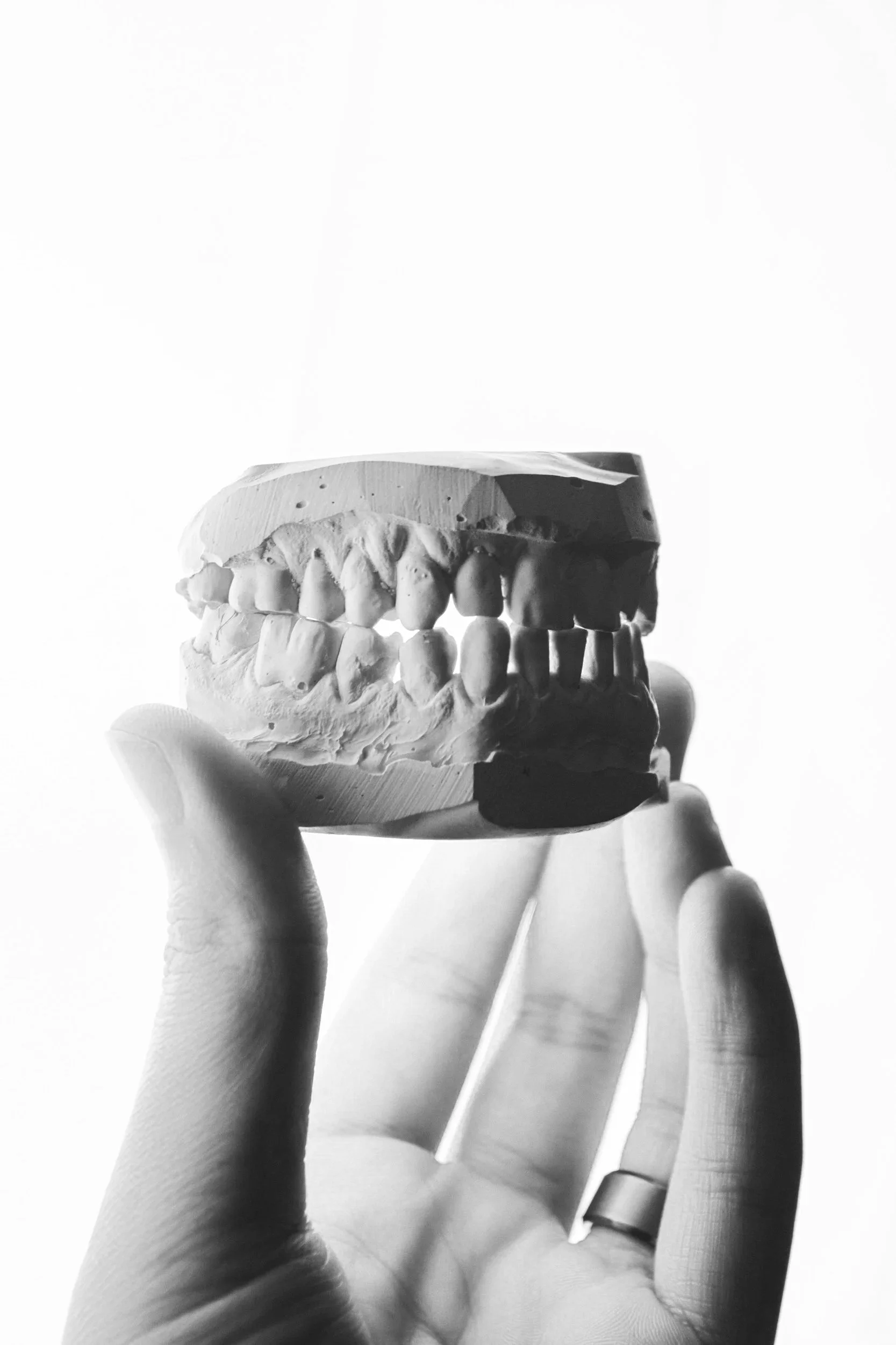 A hand holding a dental model viewed against a plain background.