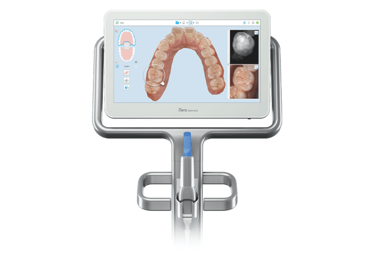 digital scan of teeth