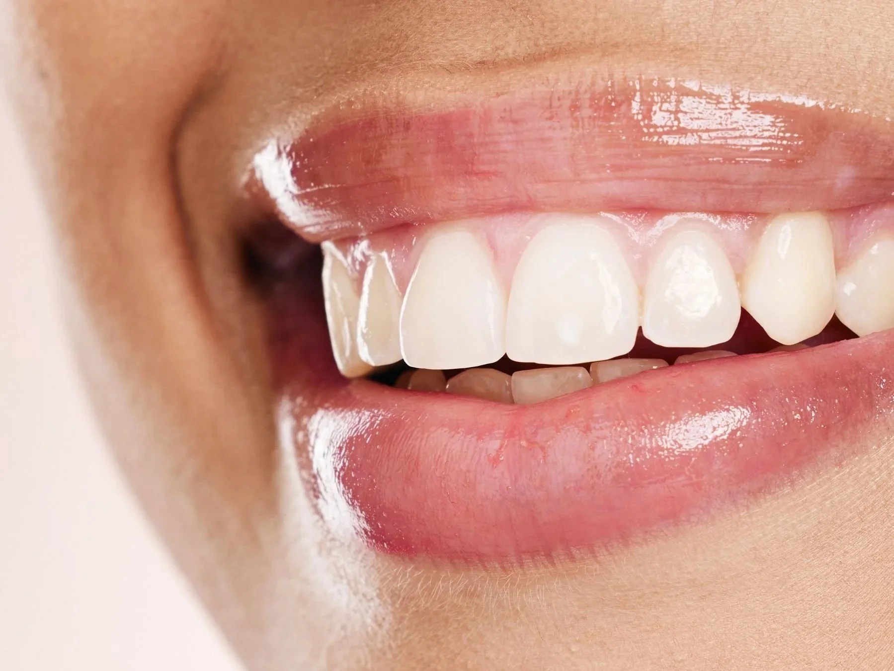 Close-up of a person's smile showcasing white teeth and glossy lips.