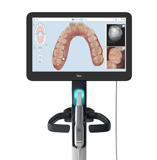 A dental 3D scanner displaying a digital 3D model of a patient's upper teeth on a touchscreen monitor against a black background for Invisalign.