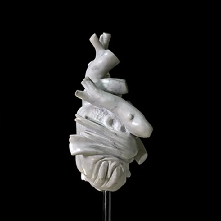 Heart (Left Side) 