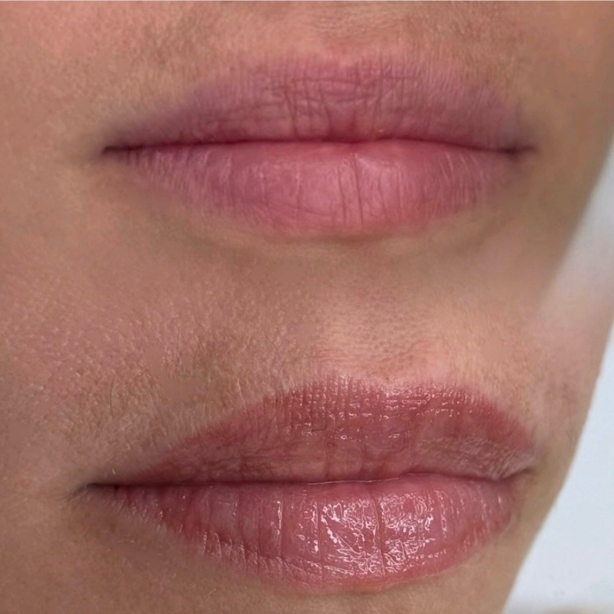 Close-up of person's lips and surrounding skin.