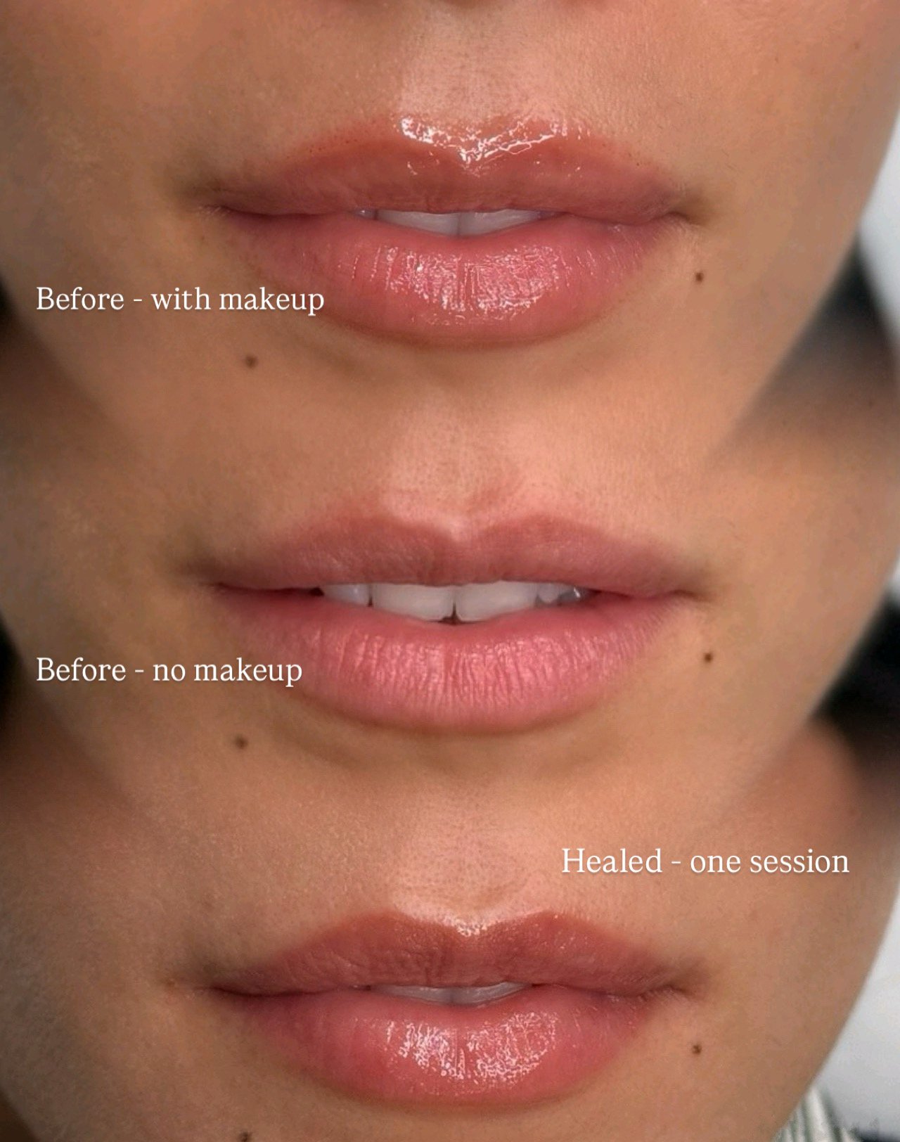 A comparative image showing the lips before and after makeup application. The top part shows lips with makeup, appearing glossy and enhanced. The middle part shows lips without makeup, natural and matte. The bottom part shows lips after a single sess