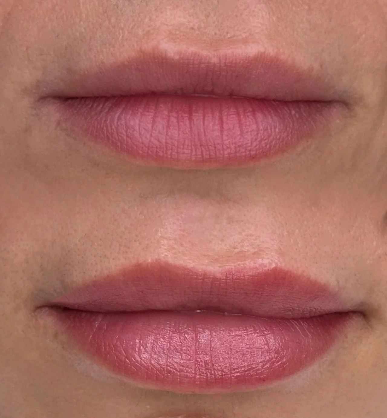 Close-up of a person's lips showing a before and after comparison, with the top lip appearing more natural and the bottom lip slightly enhanced.