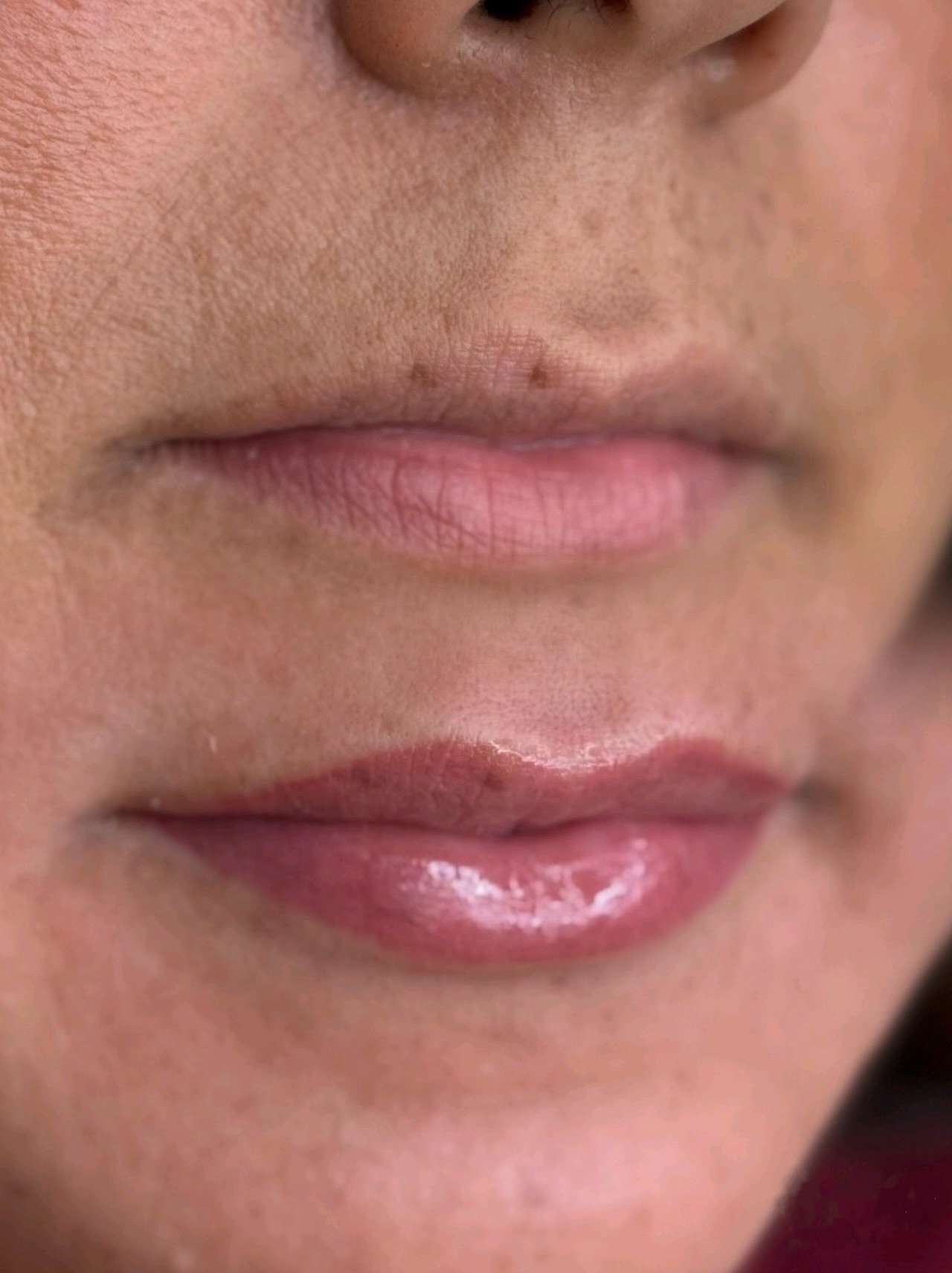 Close-up of a person's lips, showing natural skin texture with some small moles, and glossy pink lipstick.
