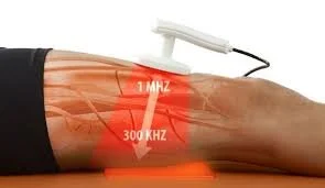 winback treatment 1.jpg