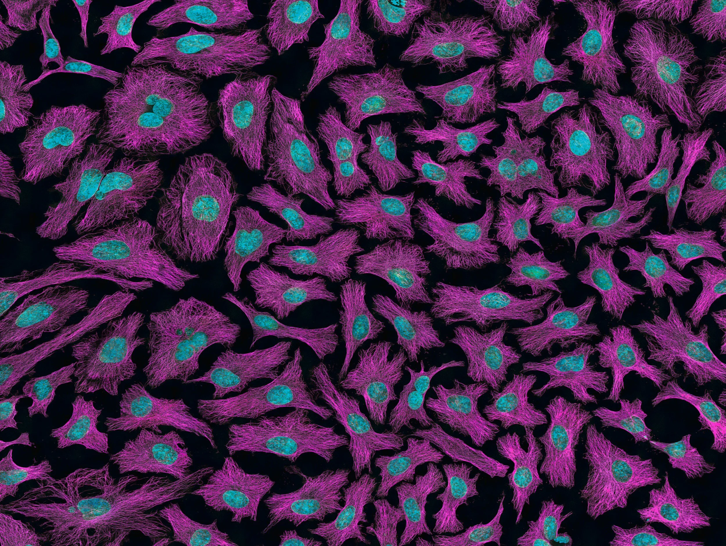 Colorized microscopic view of multiple cultured cells with purple fibers and blue nuclei on a black background.
