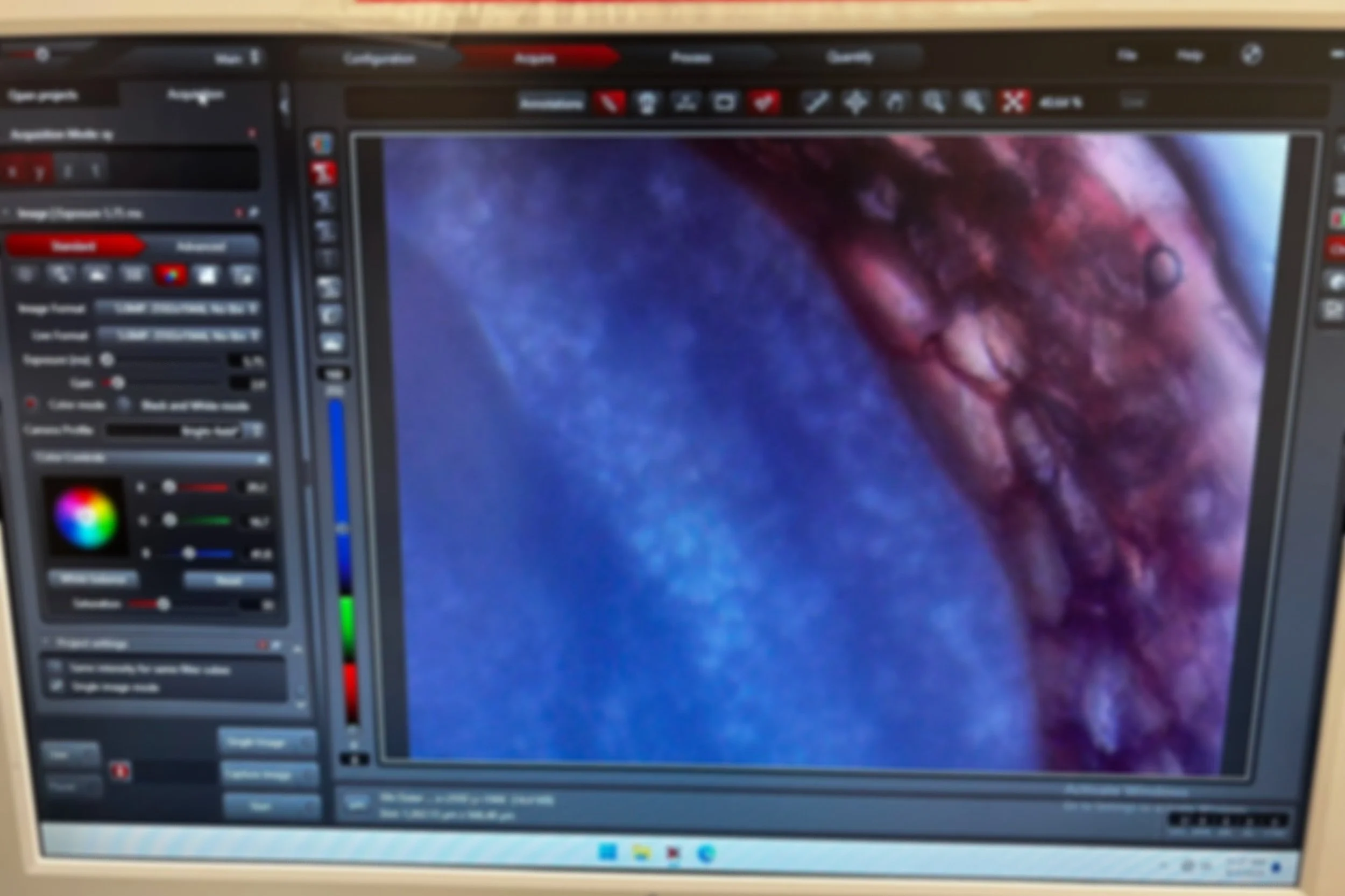 Photomicrograph of cranberry seed cross section under a microscope over a computer screen