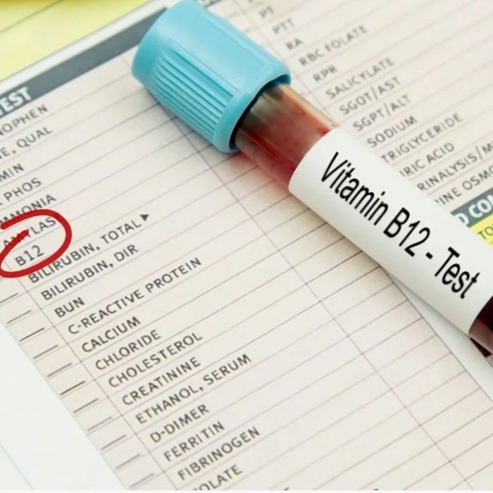 Your B12 status deserves a closer look 
