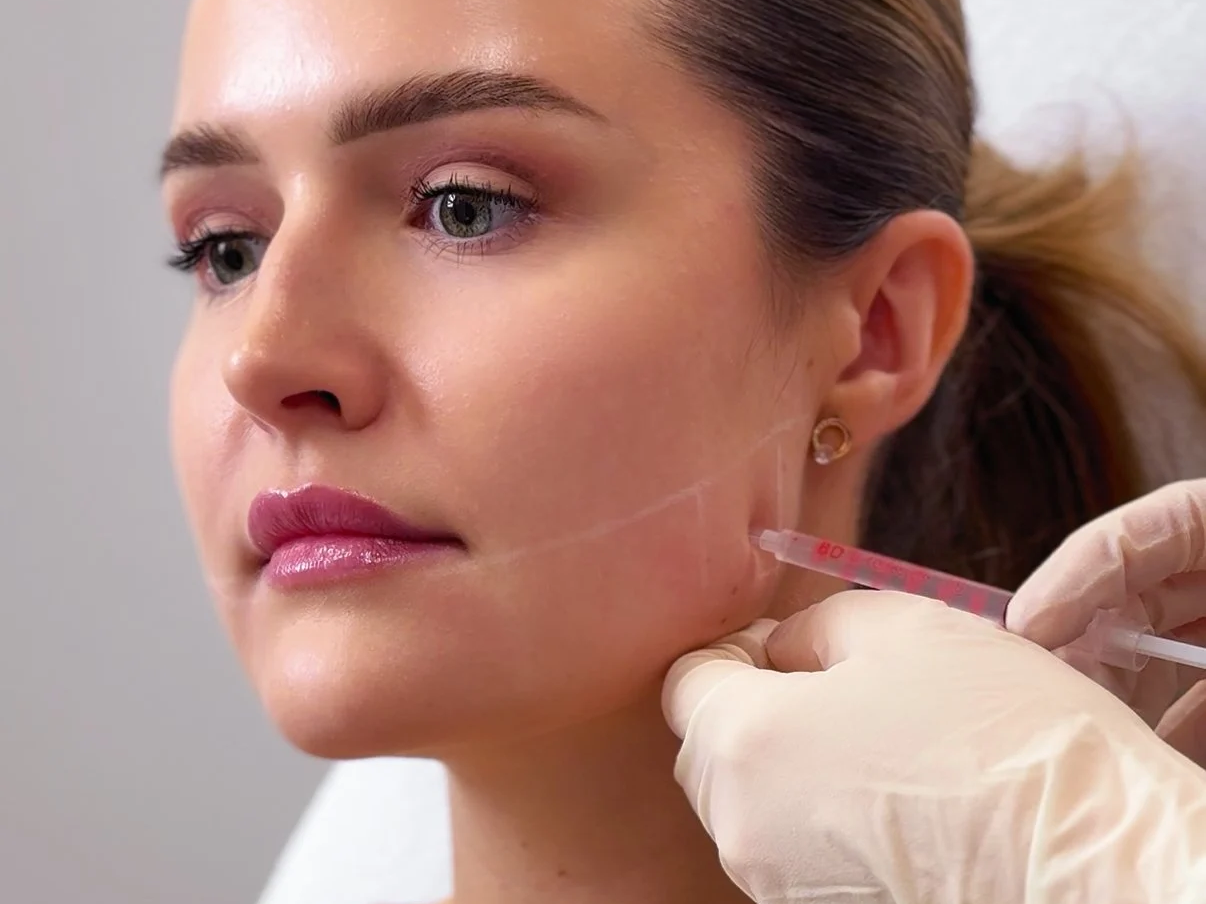 Botoks — fakty i mity, które powinnaś znać przed zabiegiem