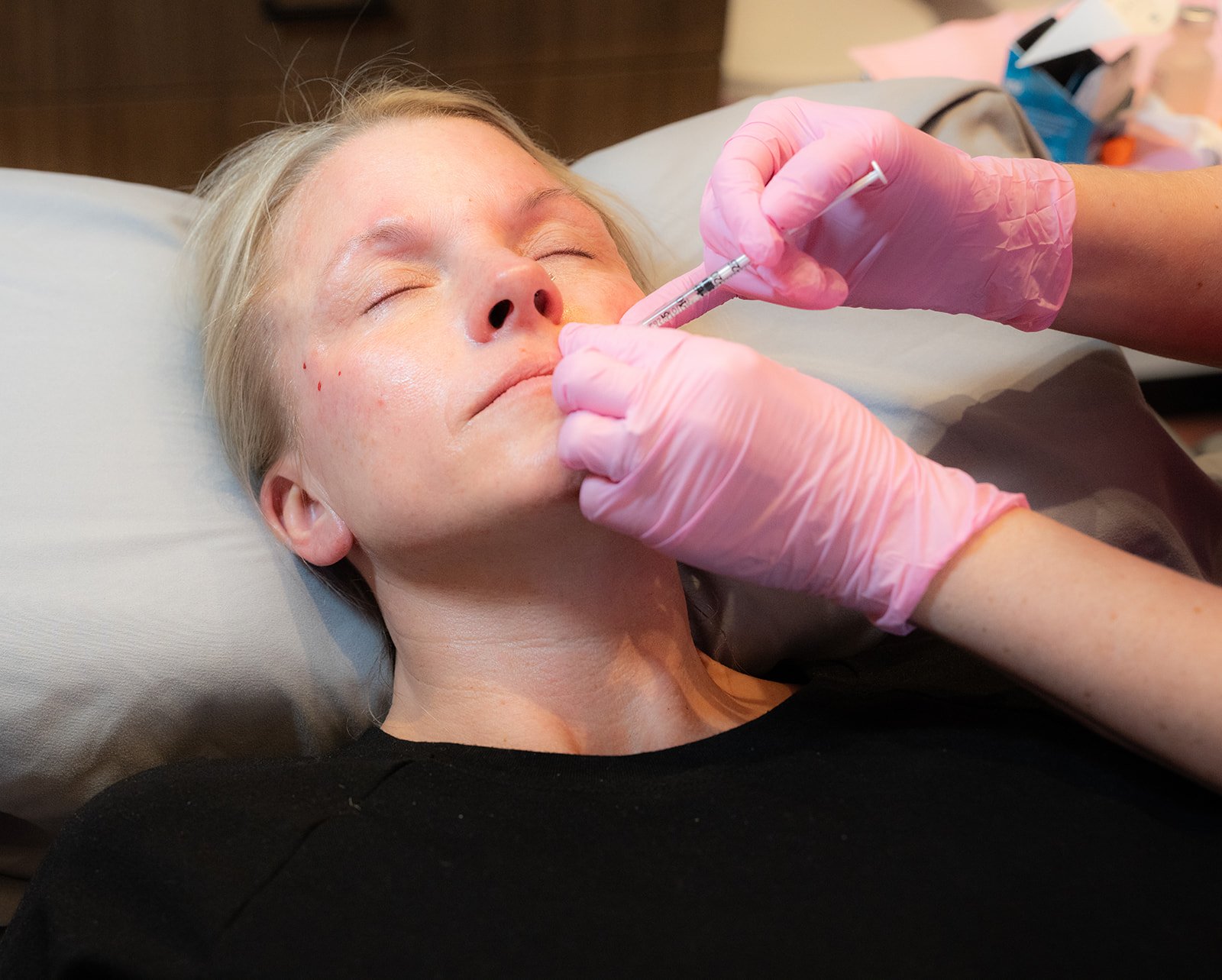 Lip filler treatment at DayDreams Med Spa & Retreat in La Vista, NE