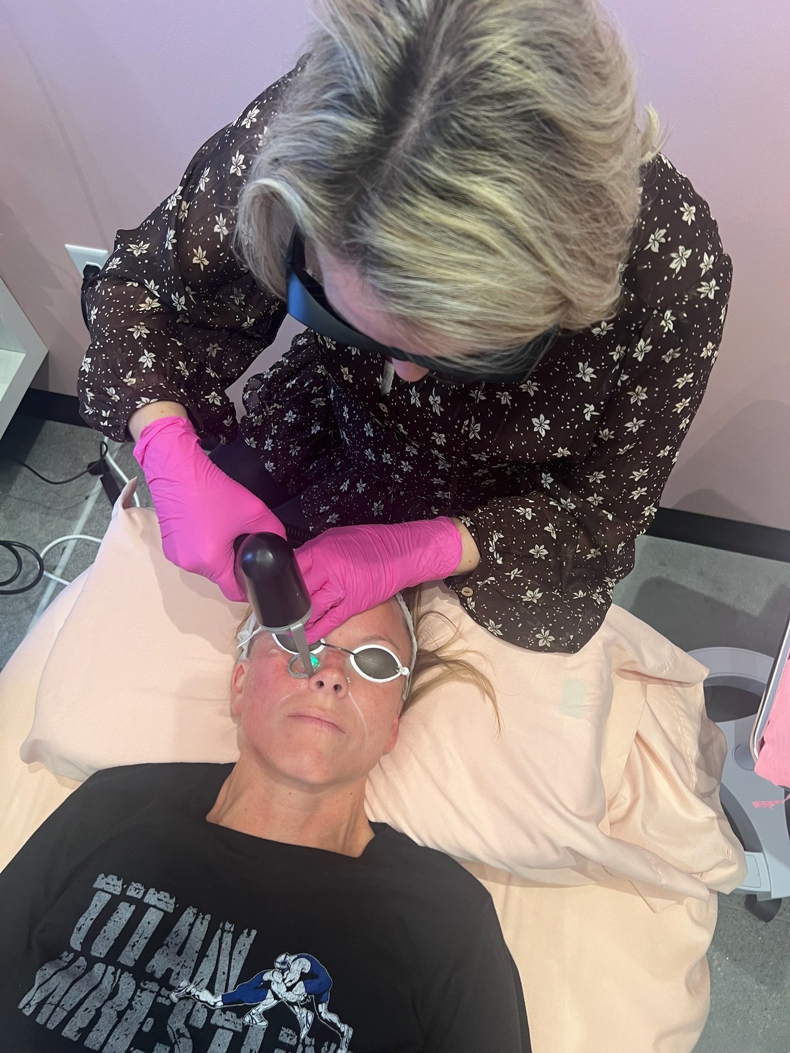 adva tx laser on patient face