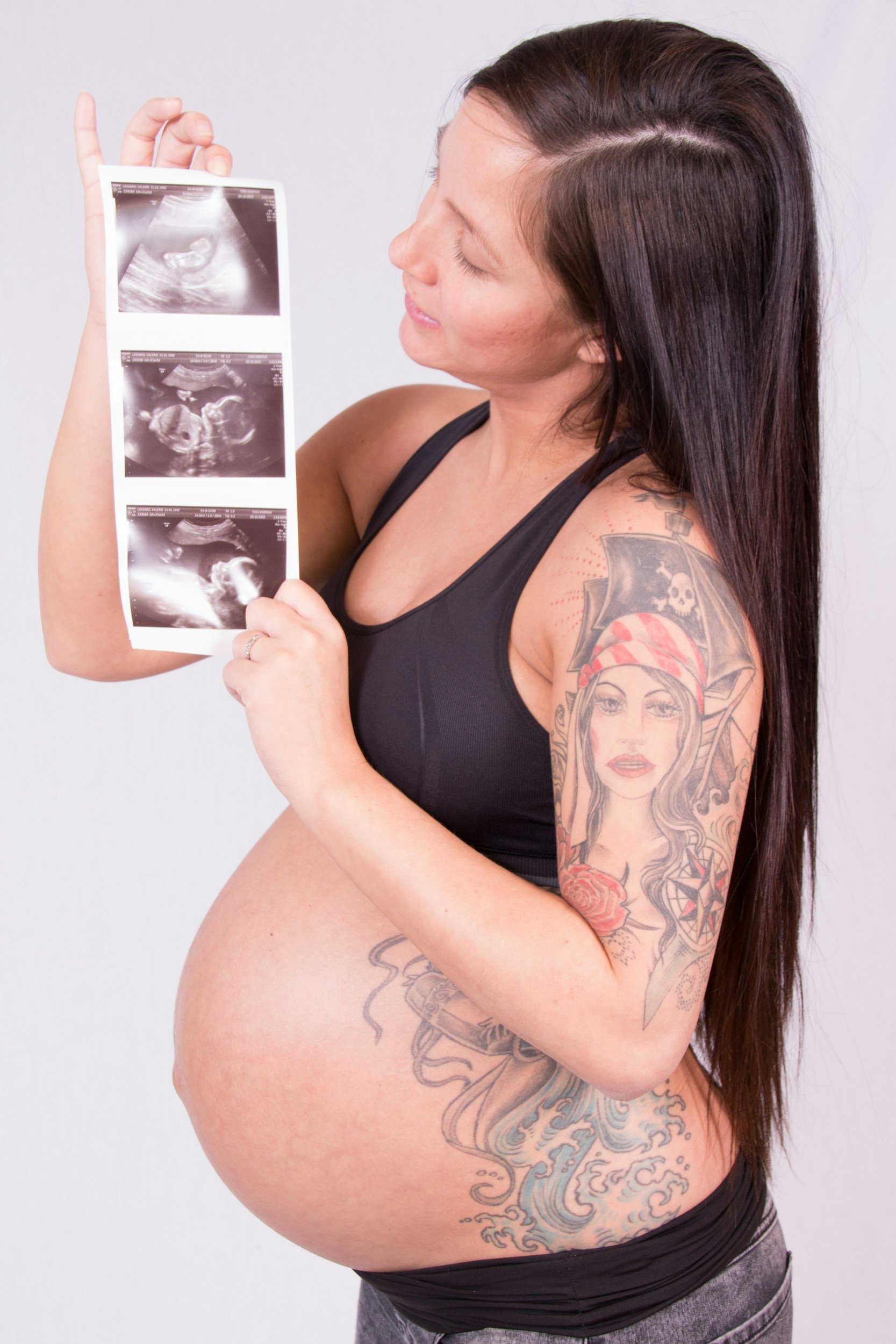 Como funciona o ultrassom na gravidez no Reino Unido