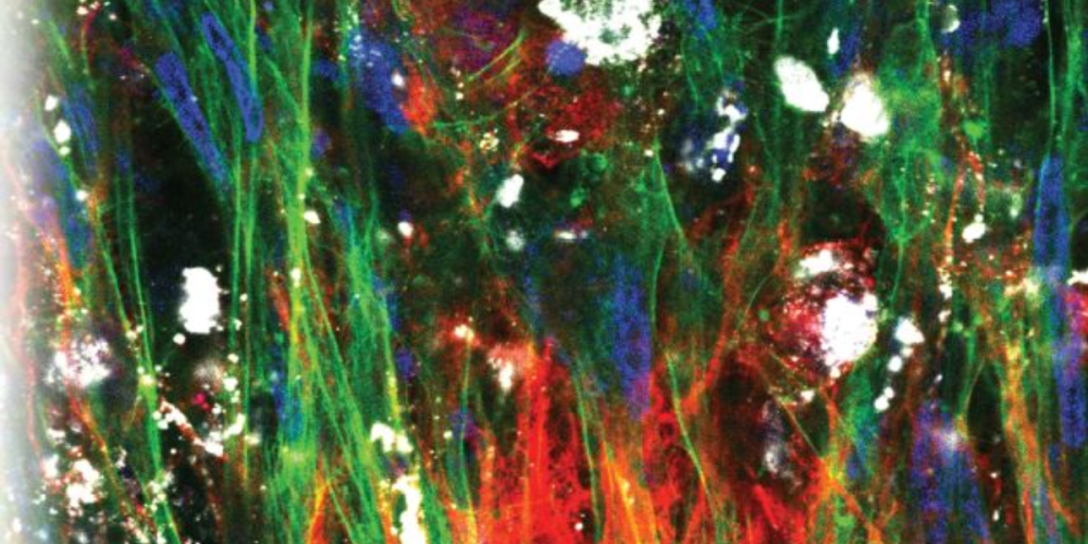 PhD Defense – Exploring neural models for human cytomegalovirus infection studies