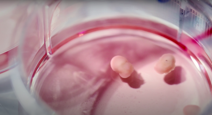 Human Brain Organoids to Study Infectious Diseases