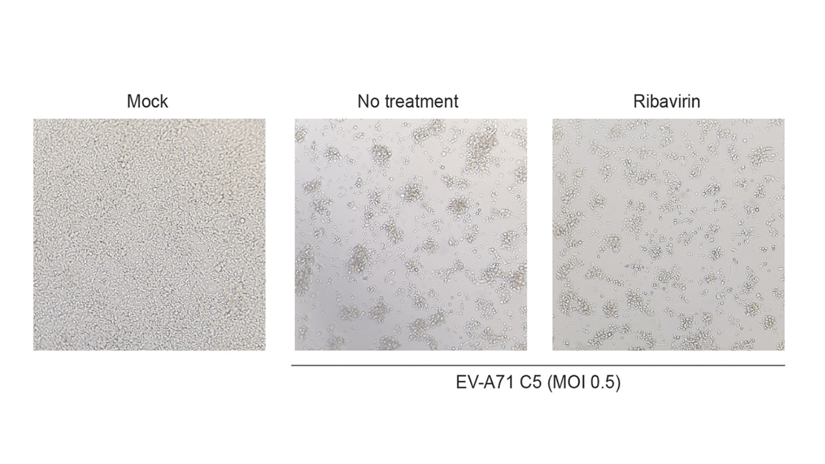 Human Dendritic Cells Transmit EV-A71