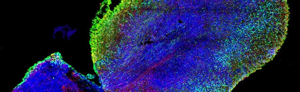 Organoids for HIV Research: A Breakthrough in HIV Treatment and Prevention