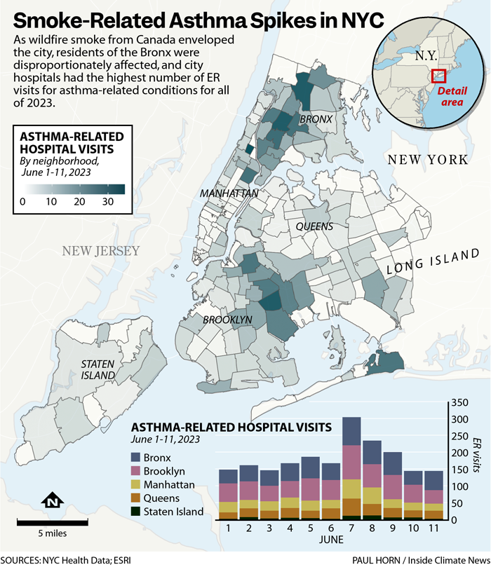 ER Visits for Asthma in New York City Soared as Wildfire Smoke Blanketed the Region