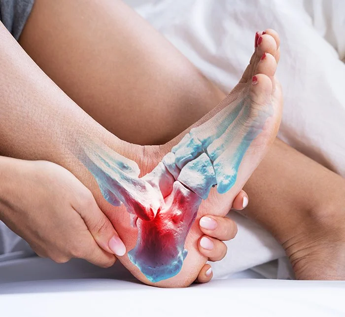 Understanding Plantar Fasciitis: Causes, Symptoms and Practical Support