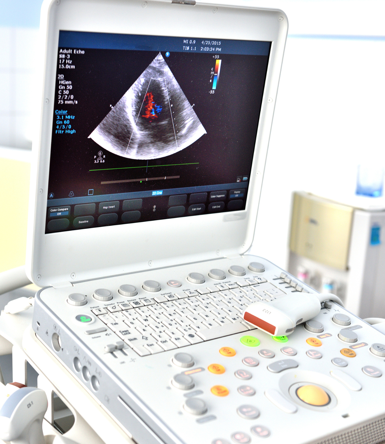 Medical ultrasound machine displaying a color Doppler ultrasound image of a heart in a clinical setting.