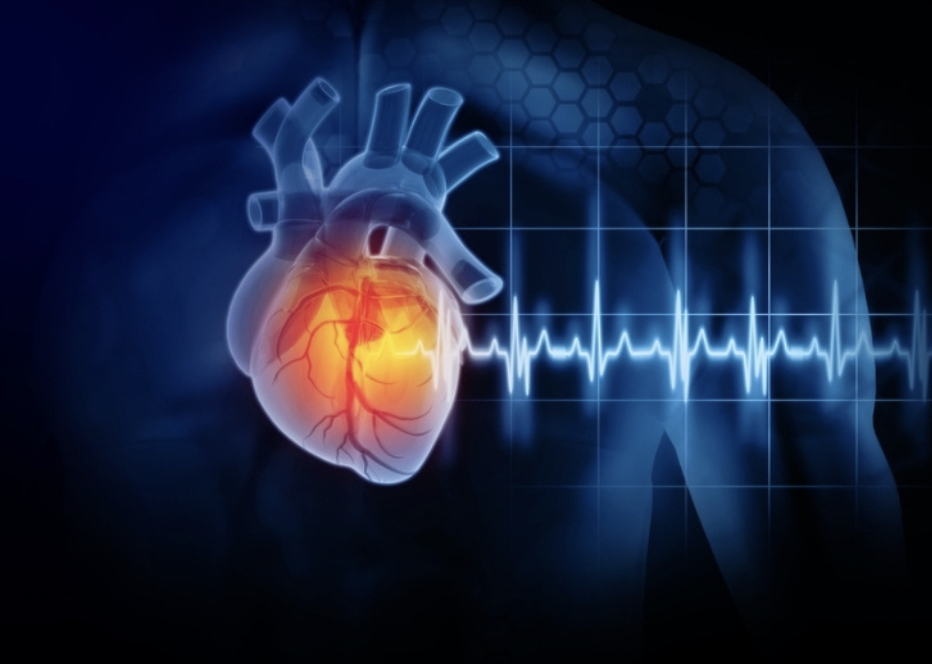 Heart Failure - Unbranded