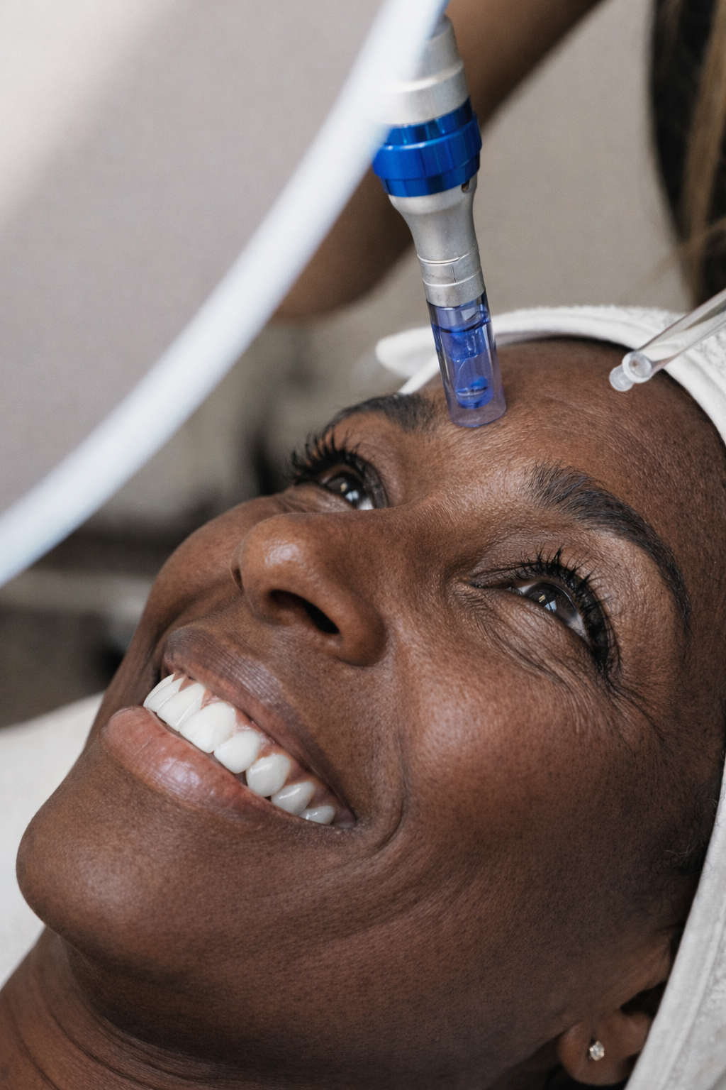 Medspa in Tucson, AZ, 85719 | Microneedling with PRP Near Me