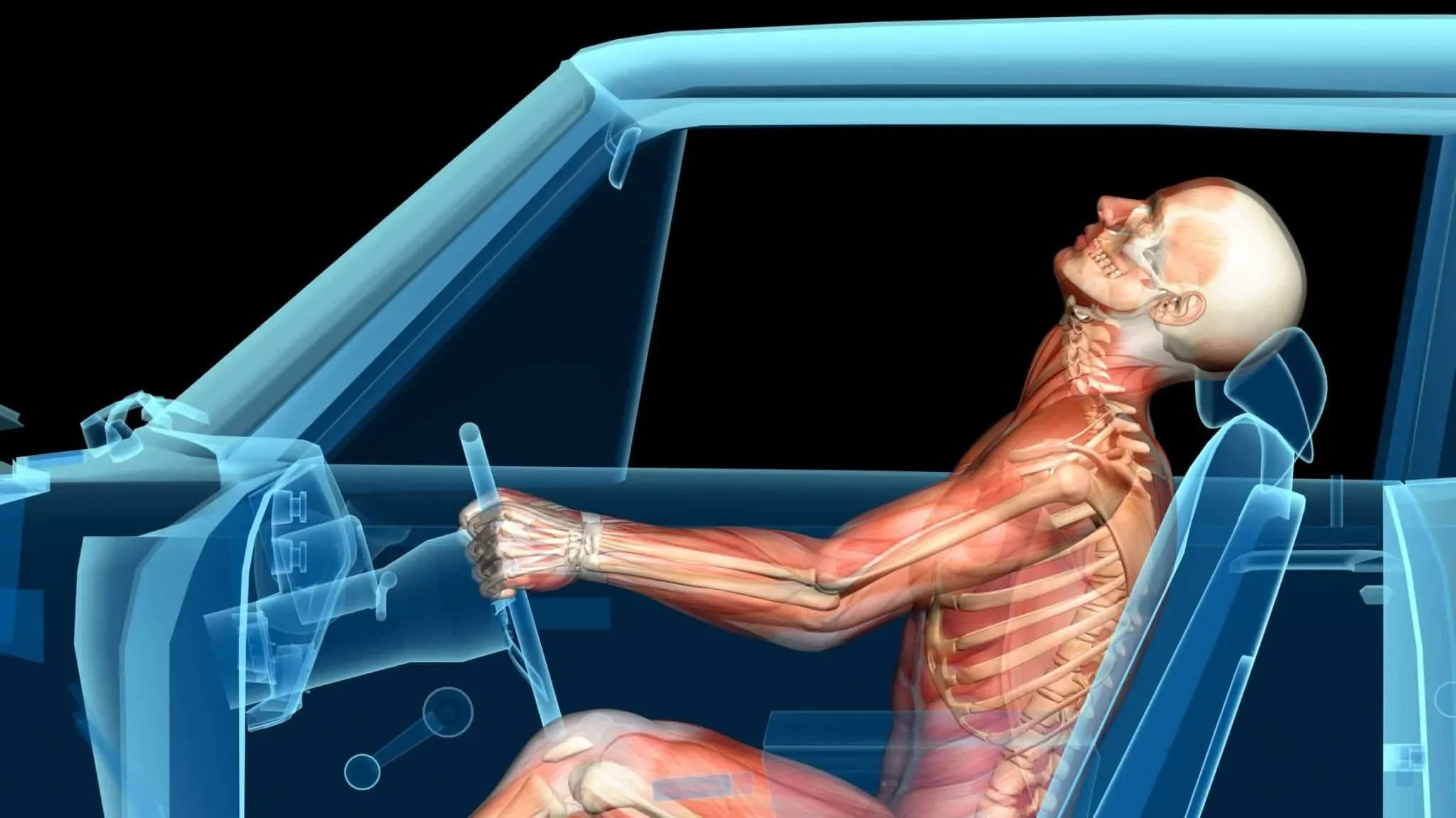 AUTO INJURY
