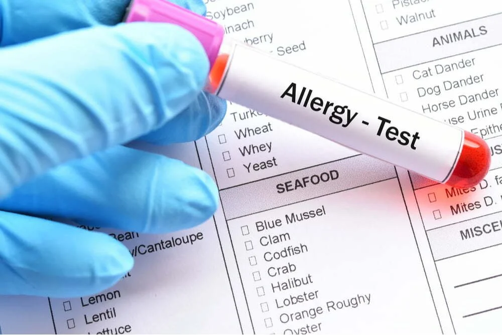 NUTRITION & TESTING
