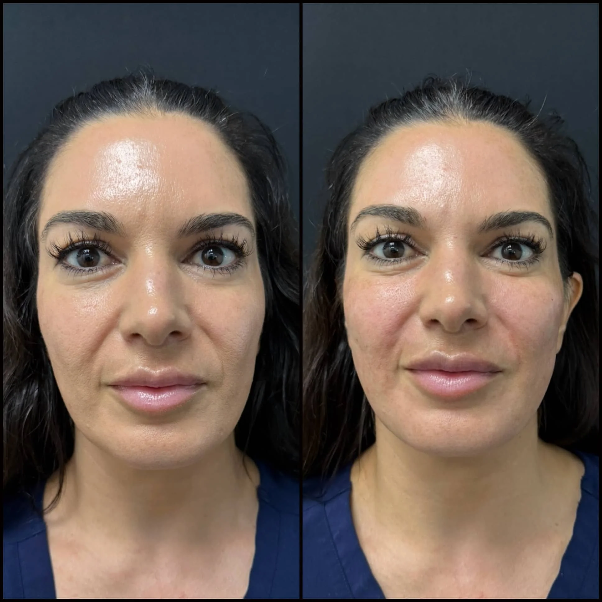 Side-by-side comparison of a woman's face before and after skincare treatment, showing improved skin texture and tone.