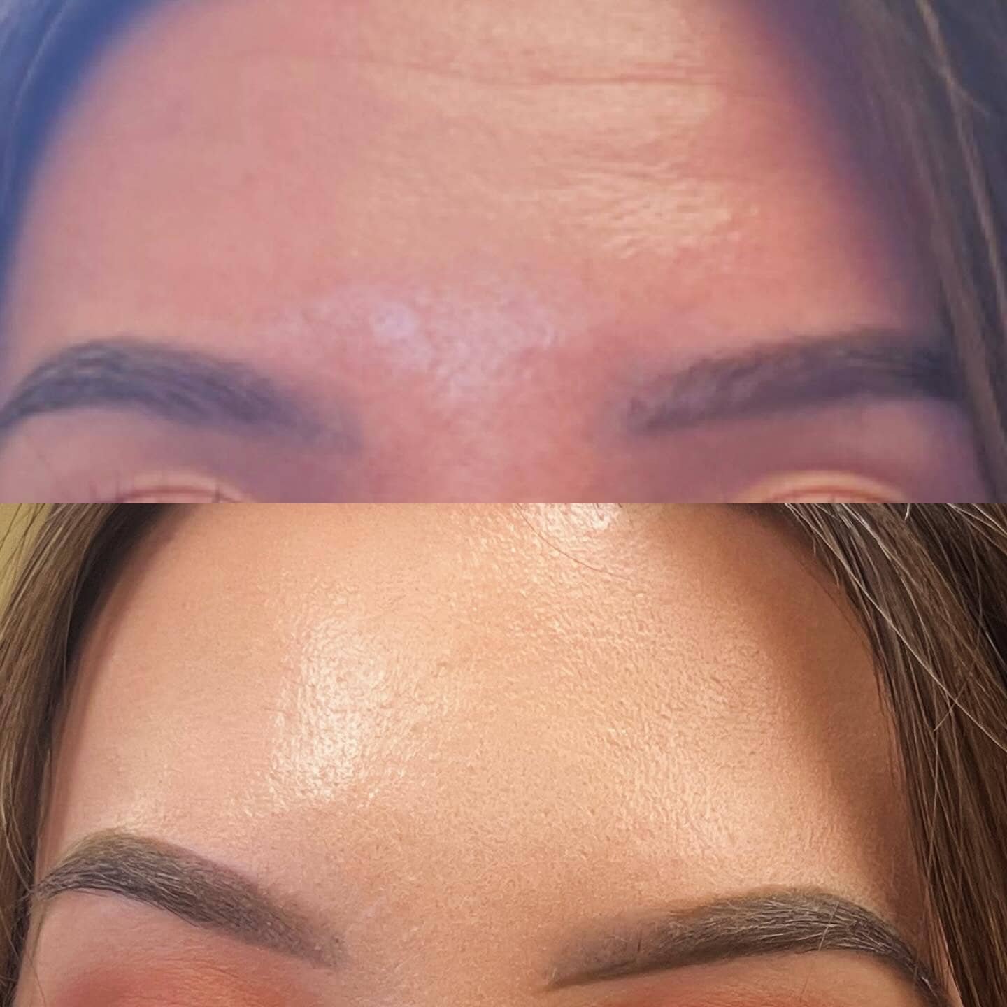 Close-up of a person's forehead demonstrating skin condition before and after makeup application, with smoother appearance after makeup.