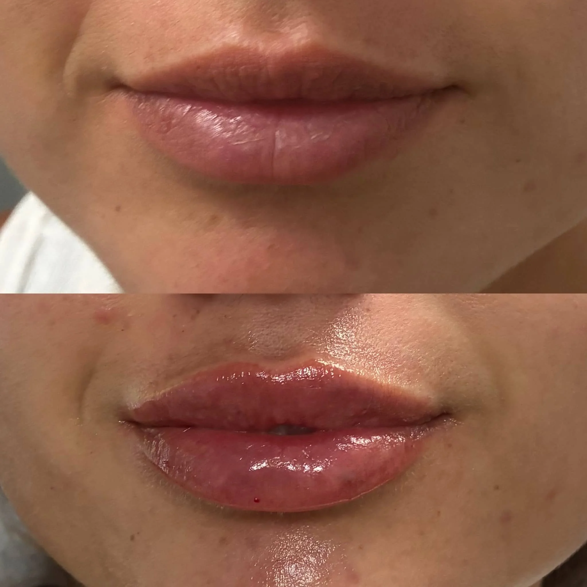 Close-up of person's lips before and after applying lip gloss or lipstick