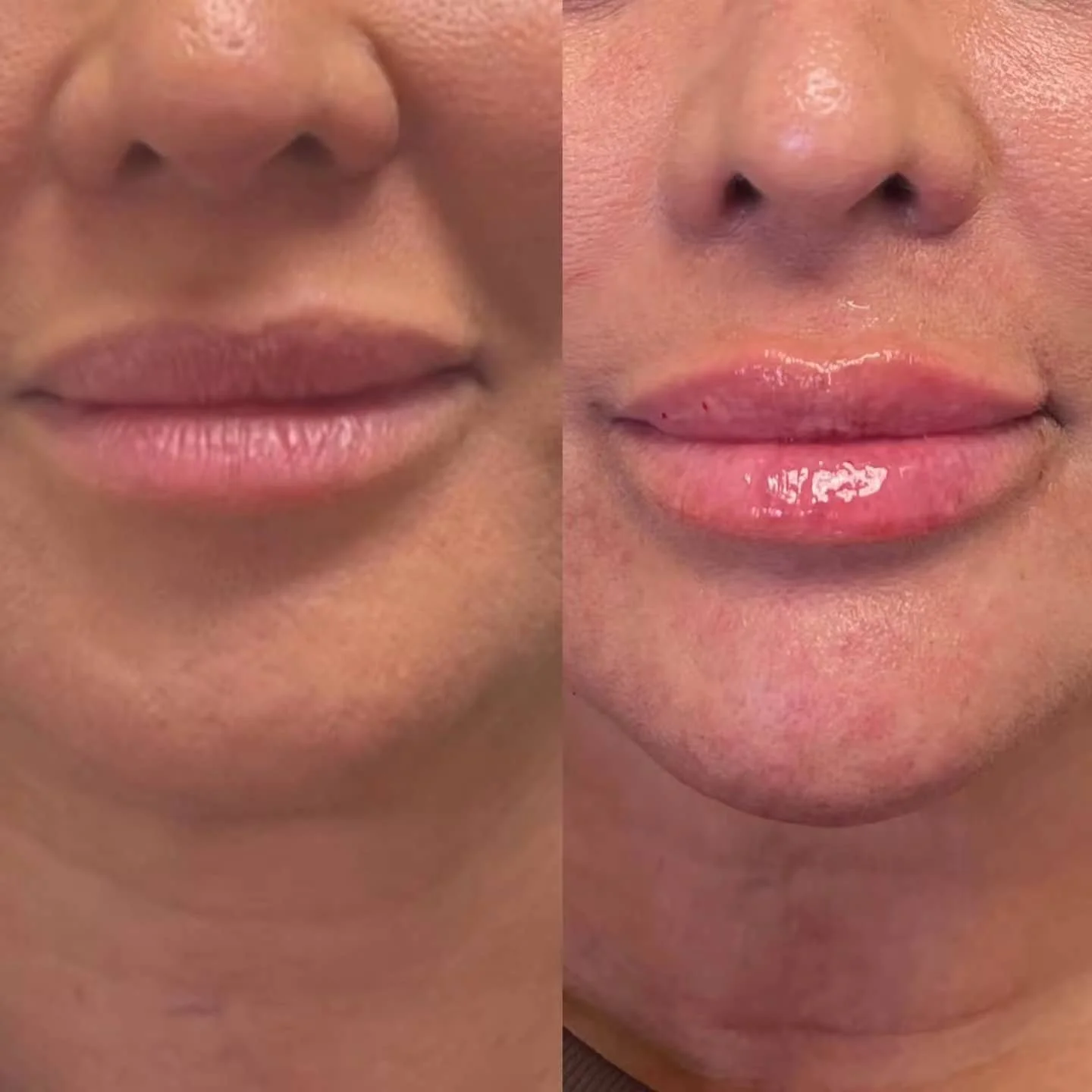 Close-up of a person's lips before and after lip gloss application, showing transformation from matte to shiny lips.