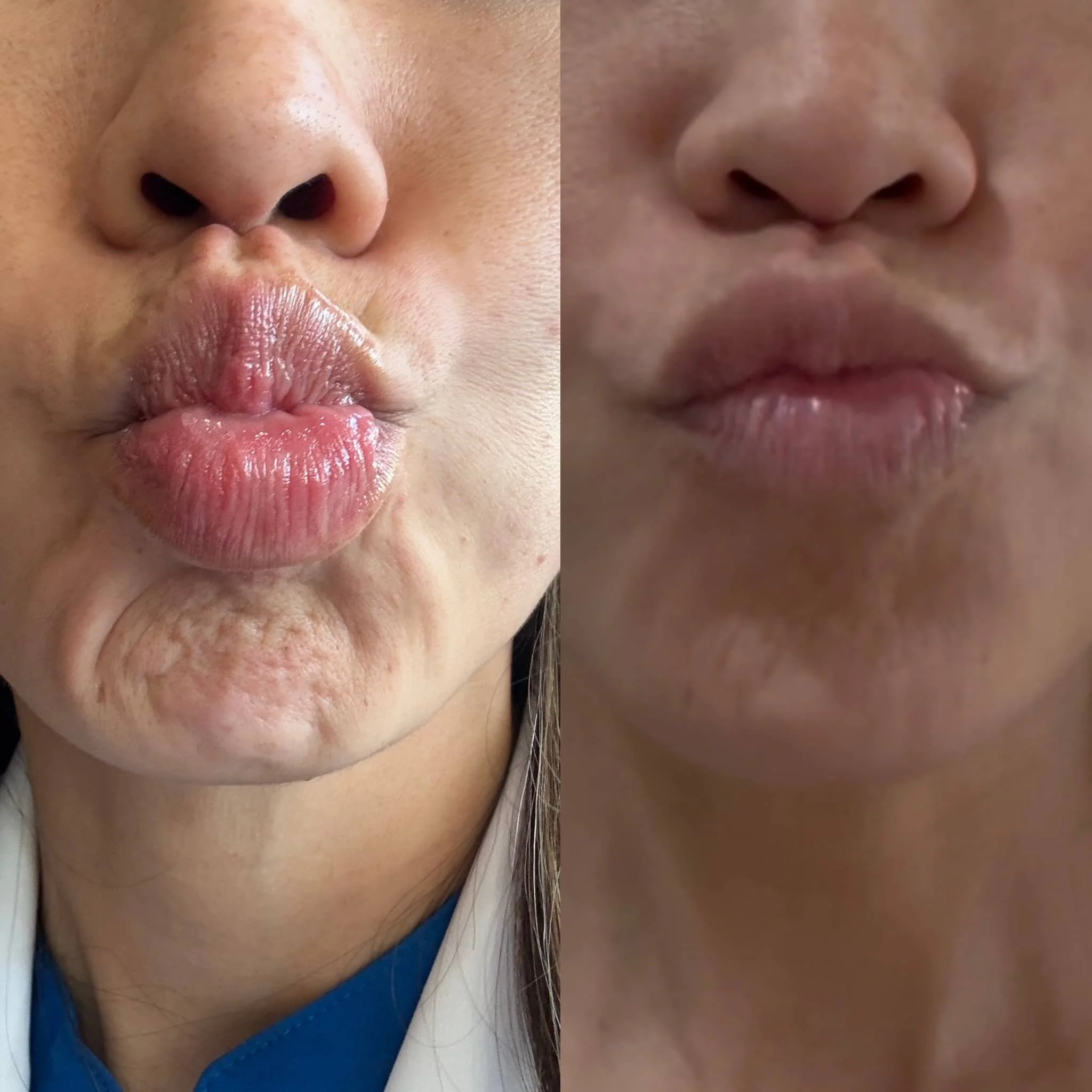 Split image showing close-up of lips and nose, with the left side featuring full lips making a kiss face and the right side showing a compressed lips pose.