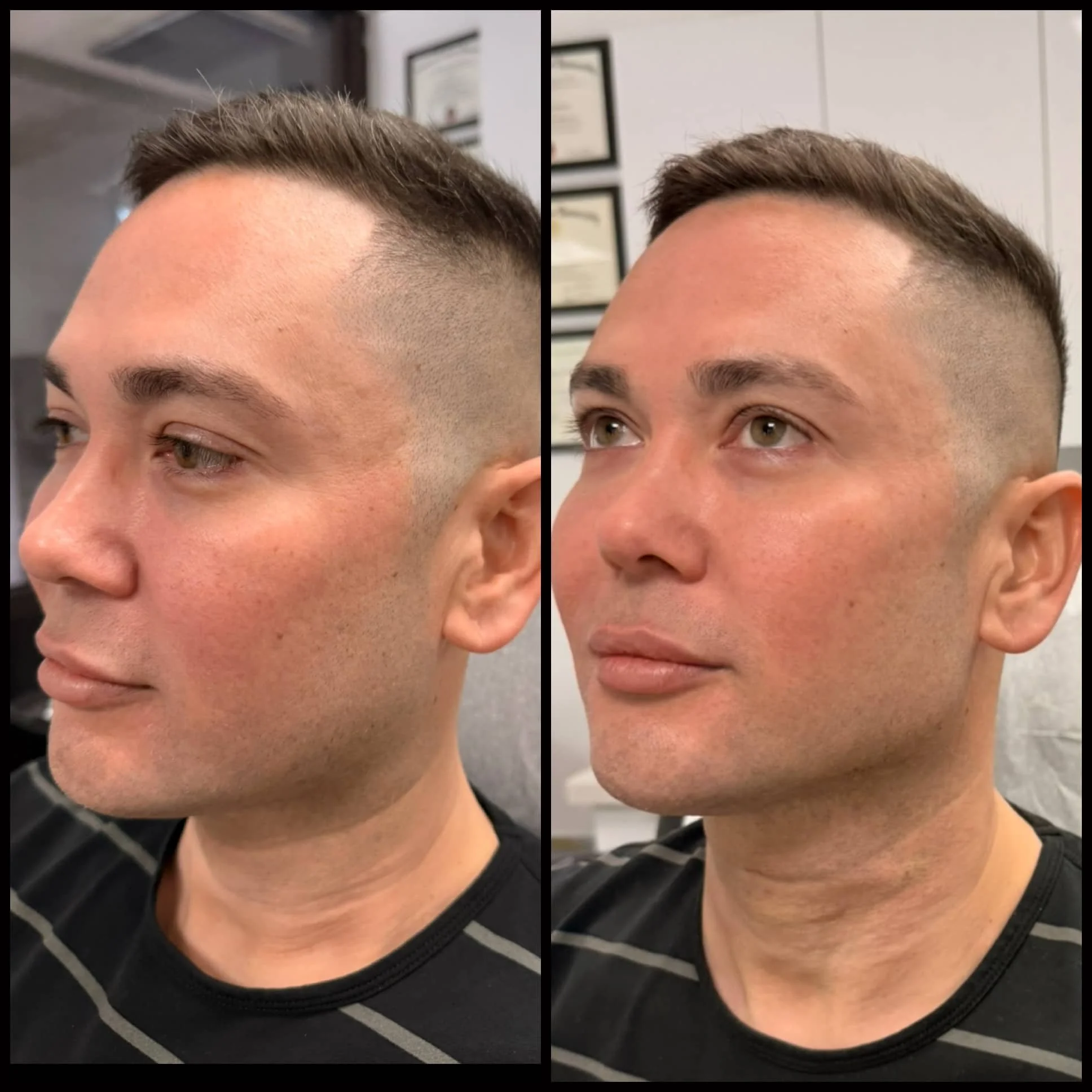 Side-by-side images of a man showing his face from the left and front angles. The man has short brown hair with a fade haircut.