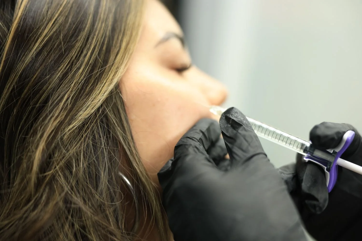 Close-up of a gloved hand guiding a filler syringe toward a woman's cheek and smile line area.