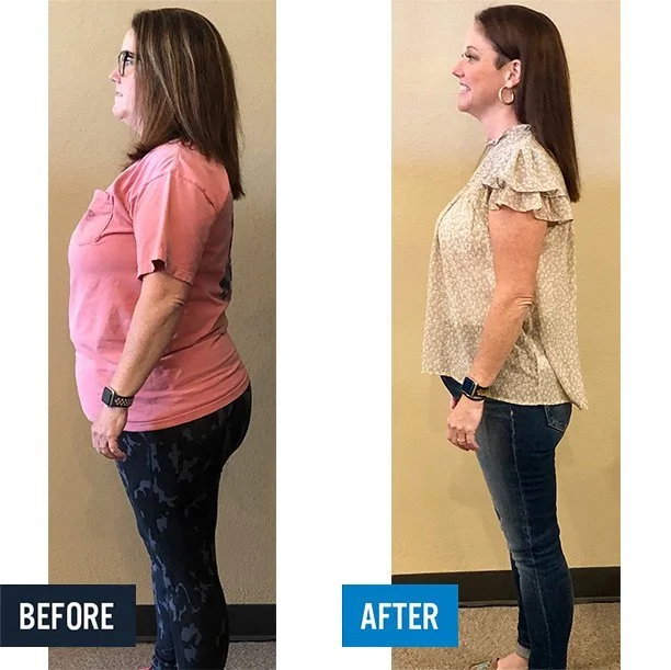 Before-After-Elise-Down-61lbs-Side (1).jpg