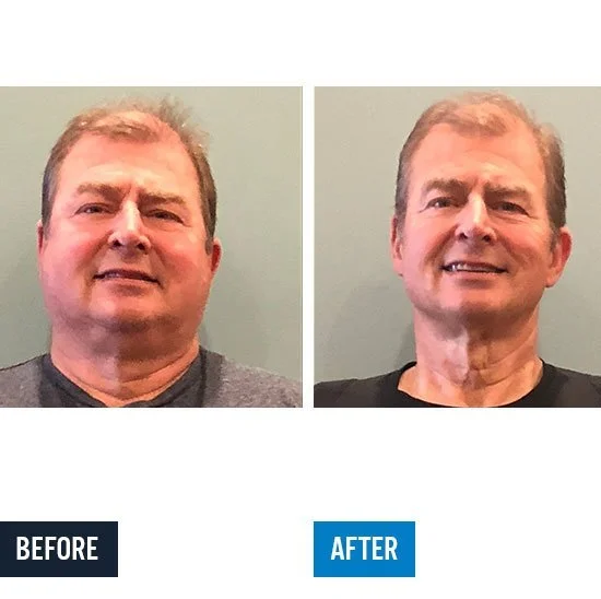 bill-cummins-face-x2.60lbs-down-4.5-avgjpg.jpg