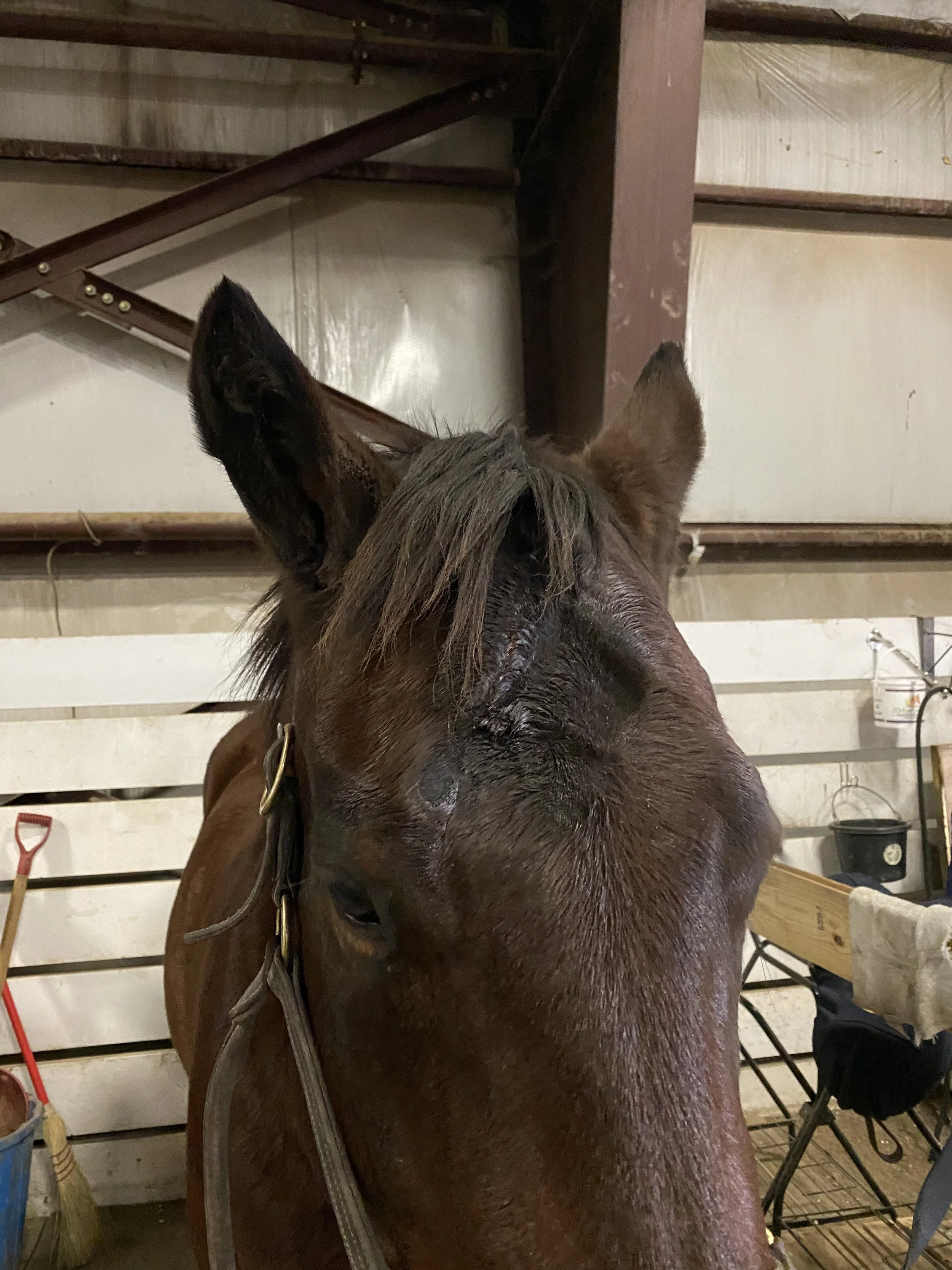 After third treatment, complete filled in and healed without a scar