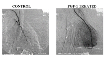 Comparison of two medical images showing blood vessels, labeled 'Control' on the left and 'FGF-1 Treated' on the right, illustrating blood vessel growth and repair.